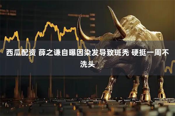 西瓜配资 薛之谦自曝因染发导致斑秃 硬挺一周不洗头